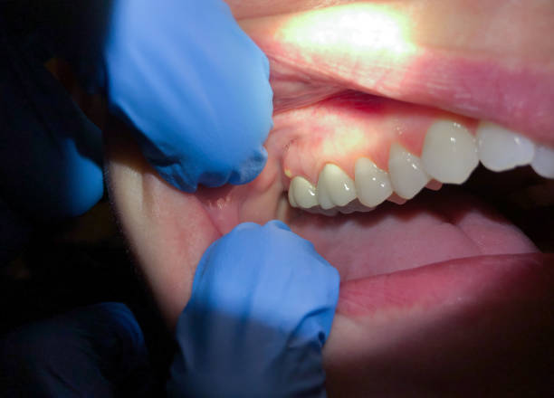 Best Weekend Emergency Dentist in Oak Grove, TN