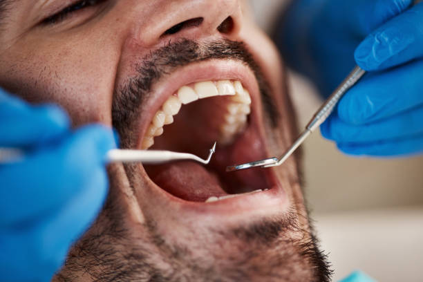 Best Broken or Cracked Tooth Emergency Dentist in Oak Grove, TN