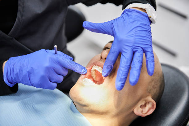Best Emergency Dental Extractions in Oak Grove, TN